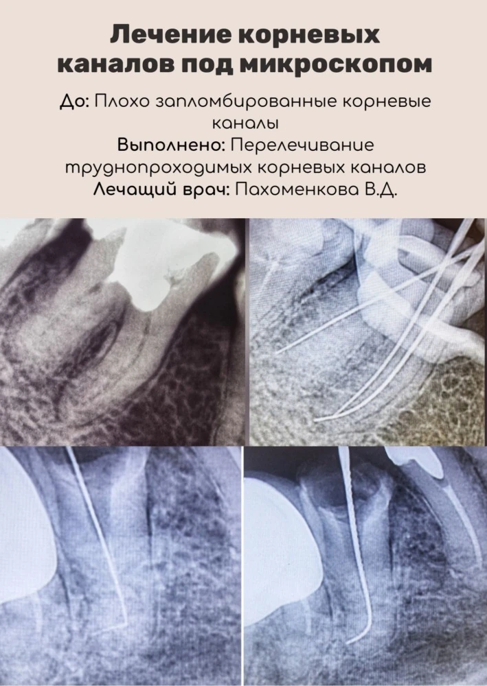 Лечение под микроскопом