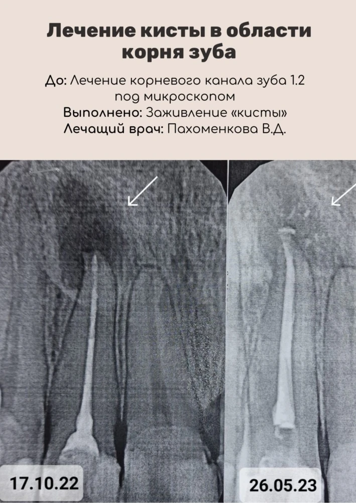 Сложное лечение под микроскопом
