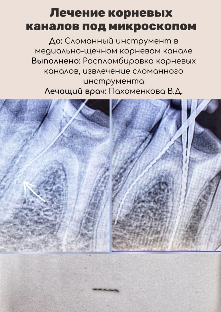 Лечение под микроскопом